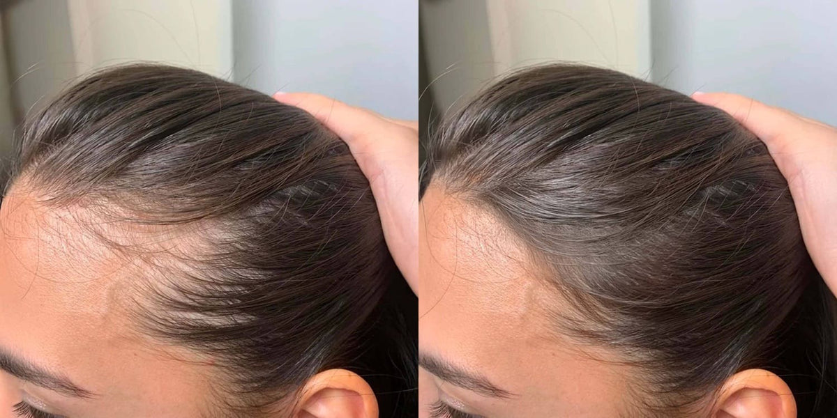 Cheveux fins femme : la solution pour un crâne moins visible