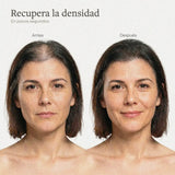 Antes y después con fibras capilares para mujer