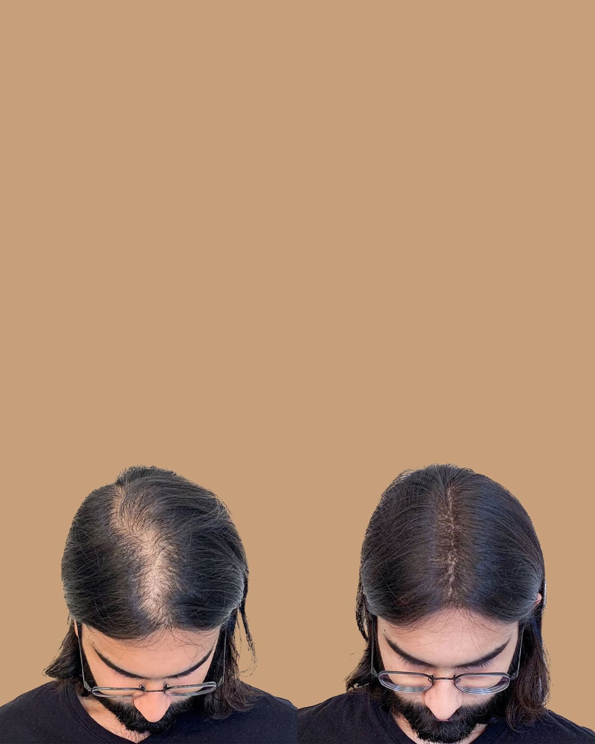 Fibre capillaire noire : densifiez vos cheveux en 60 sec