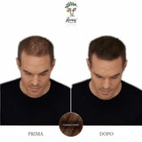 Prima e dopo con fibre castano medio: attaccatura di un uomo