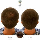 Prima e dopo con fibre castano medio: sommità del capo di un uomo