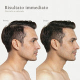 Prima e dopo l’applicazione delle fibre per capelli su un uomo di profilo