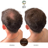Prima e dopo con fibre castane sui capelli di un uomo