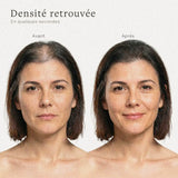 Avant après poudre densifiante cheveux femme effet volume naturel raie cheveux clairsemés