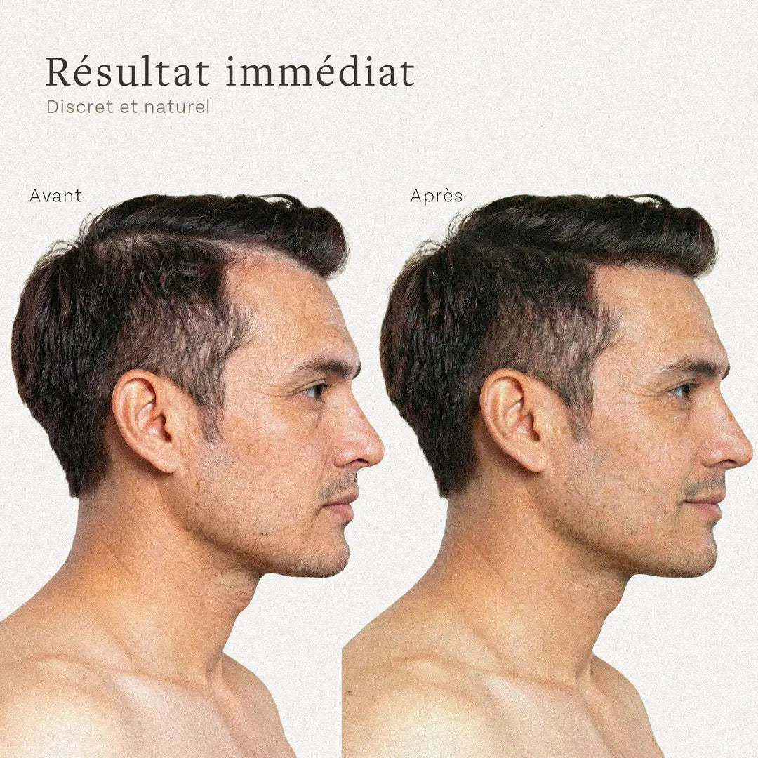 Avant après poudre densifiante cheveux homme effet naturel densité cheveux