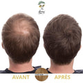 Poudre densifiante cheveux chatain homme avant apres Avey