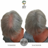Streuhaar vorher und nachher bei einer Frau – Grau