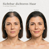 Streuhaar für Frauen – vorher und nachher mit mehr Haarvolumen