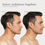 Streuhaar vorher und nachher bei einem Mann im Profil