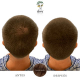 Antes y después con fibras capilares castaño medio para hombre, vista de la coronilla