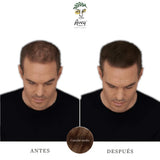Antes y después con fibras capilares castaño medio para hombre, vista frontal